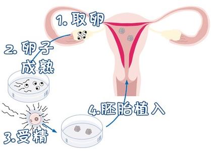 培养室